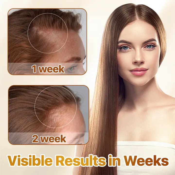 Fivfivgo™ Hair Revive Hair Growth Spray