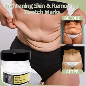 Fivfivgo™ Korean Snail Collagen Lifting & Firming Body Cream
